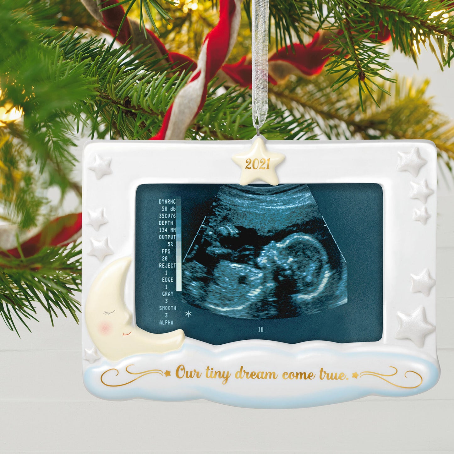Hallmark QHX4065 Dream Come True Sonogram  Porcelain Photo Frame 2021 Ornament-DAMAGED BOX